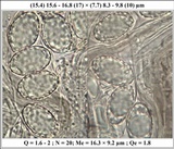 Peziza succosella image