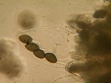 Schizothecium tetrasporum image