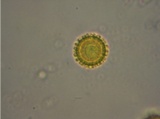 Hypomyces microspermus image