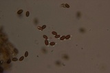 Psilocybe semilanceata image