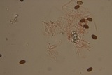 Psilocybe semilanceata image
