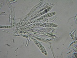 Mollisia ventosa image