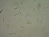 Mollisia ventosa image