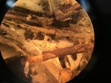 Amphinema byssoides image
