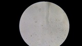 Phellinus robiniae image