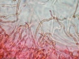 Dacryopinax elegans image