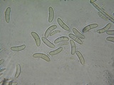 Perrotia flammea image