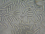 Perrotia flammea image