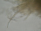 Perrotia flammea image