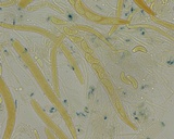 Tatraea macrospora image
