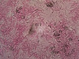 Marchandiomyces corallinus image