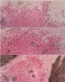 Marchandiomyces corallinus image