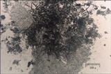 Clonostachys rosea image