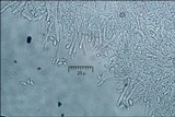 Clonostachys rosea image