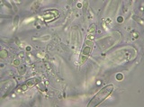 Ascocoryne sarcoides image