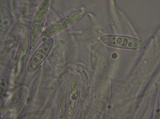 Ascocoryne sarcoides image