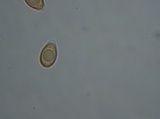 Ganoderma sessile image