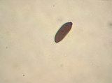 Xylaria arbuscula image