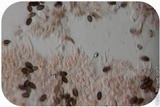 Psilocybe semilanceata image