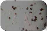 Psilocybe semilanceata image