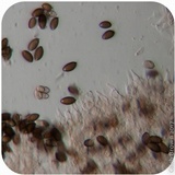 Psilocybe semilanceata image
