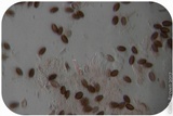 Psilocybe semilanceata image
