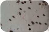 Psilocybe semilanceata image