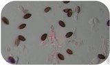 Psilocybe semilanceata image