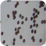 Psilocybe semilanceata image