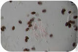 Psilocybe semilanceata image