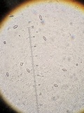 Ramaria botrytis image