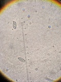 Ramaria botrytis image
