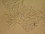 Mollisia sublividula image
