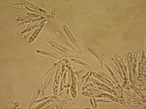 Mollisia sublividula image