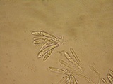 Mollisia sublividula image