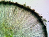Strangospora moriformis image