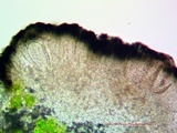Strangospora moriformis image