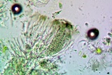 Strangospora moriformis image