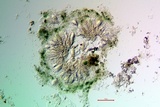 Strangospora moriformis image