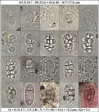Rhizocarpon reductum image