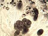 Buellia chloroleuca image