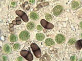 Buellia chloroleuca image