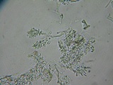 Acanthobasidium penicillatum image