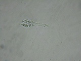 Acanthobasidium penicillatum image