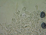 Acanthobasidium penicillatum image