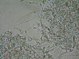 Acanthobasidium penicillatum image