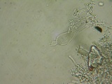 Acanthobasidium penicillatum image