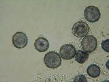 Acanthobasidium penicillatum image