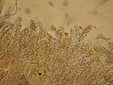 Aleurodiscus macrocystidiatus image