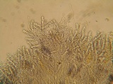 Aleurodiscus macrocystidiatus image